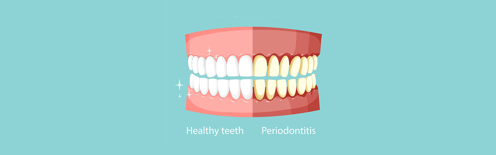 The Importance of Gum Disease Prevention: How Regular Care Can Keep Your Gums Healthy