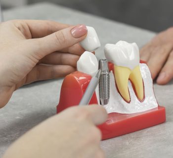 Healthy Smiles in Highlands Mountain Park Ranch: The Top Choice for Dental Implants and Restorative Care