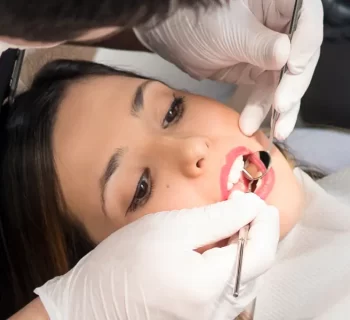 Signs You May Need a Root Canal: Advice From a Phoenix Dentist