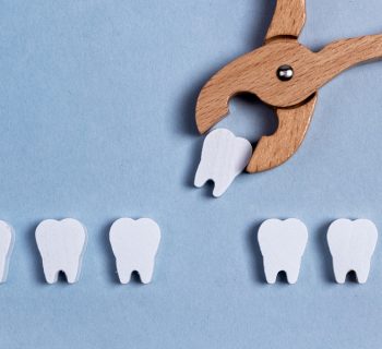 Tooth Extractions in Phoenix: What to Expect Before, During, and After Treatment
